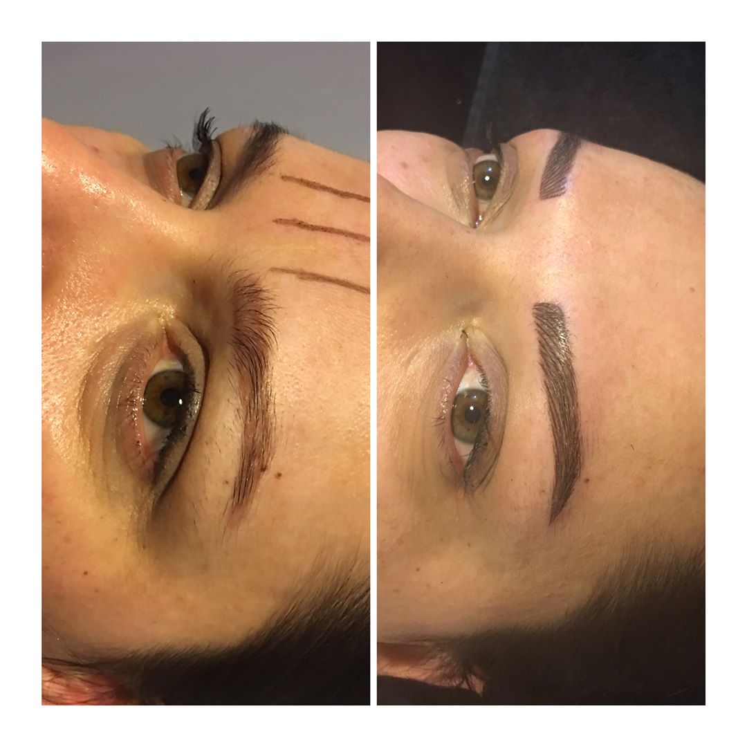 In dieser Anwendung wurde zuvor Microblading und Farbwechsel an einer Augenbraue 4D vorgenommen …