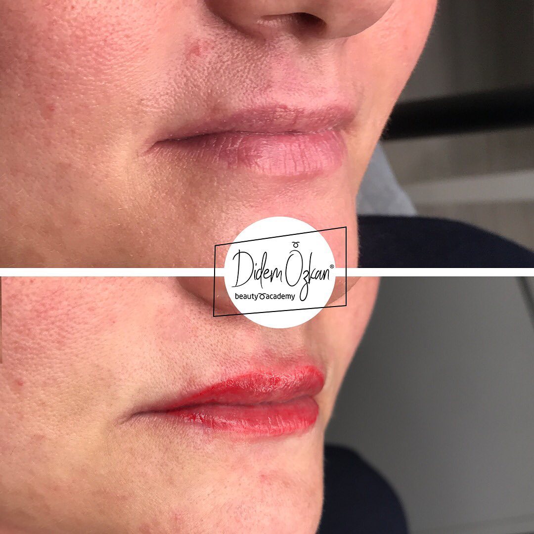 Lip Pigmentas verleiht unseren Thin Lip Clients einen volleren Look …