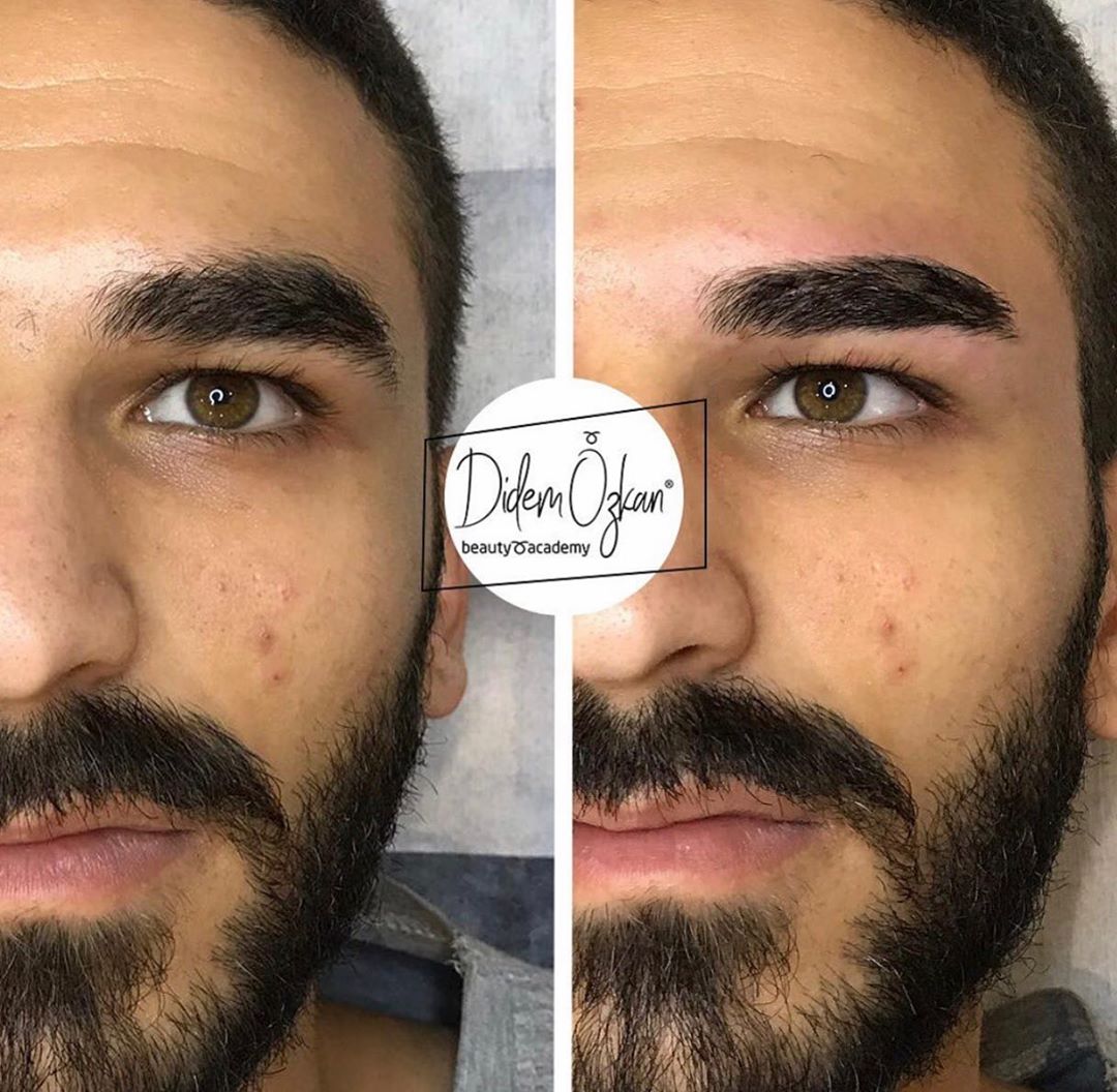 4D ANATOMIC MALE EYEBROW DESIGN-
“Ob natürlich oder natürlich … Es wird nicht natürlich sein …