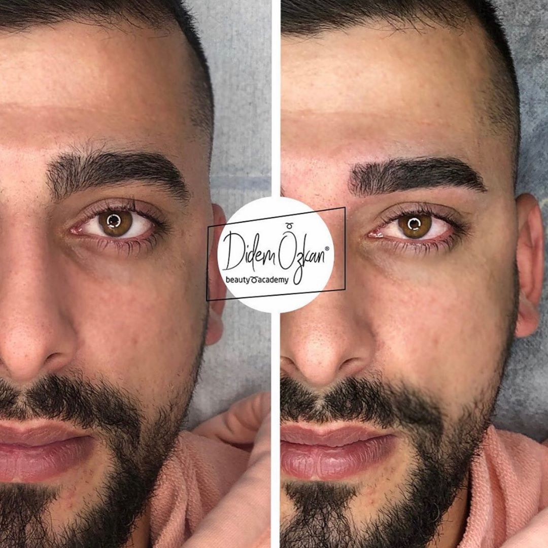 4D ANATOMIC MALE EYEBROW DESIGN
Lücken am Startpunkt der Augenbraue und …